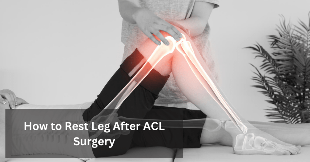 how-to-rest-leg-after-acl-surgery-a-comprehensive-guide