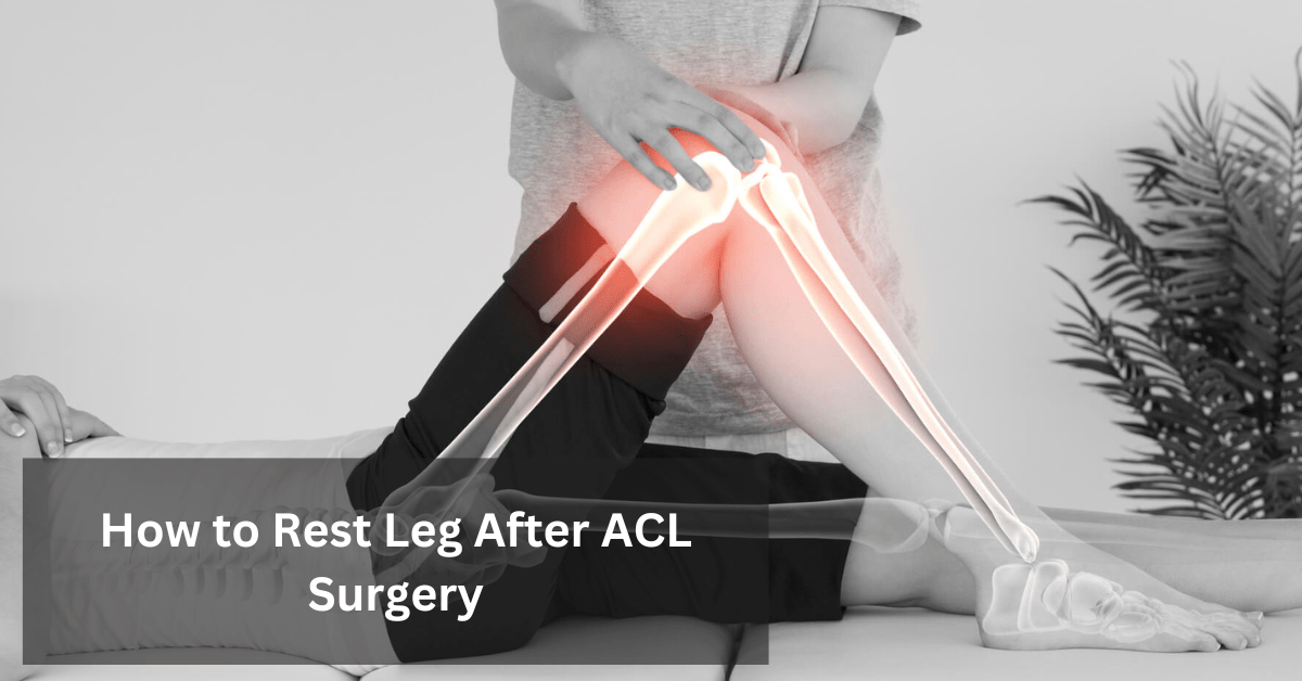 How to Rest Leg After ACL Surgery: A Comprehensive Guide