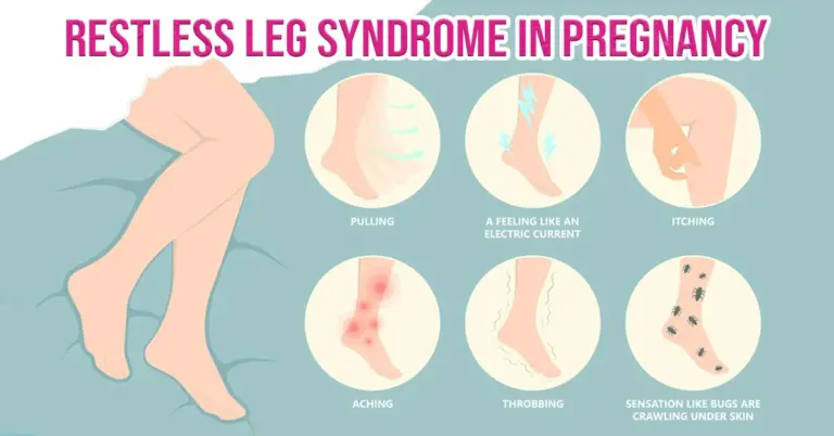 Restless Leg Syndrome in Pregnancy
