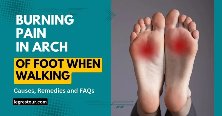 Burning Pain in Arch of Foot When Walking